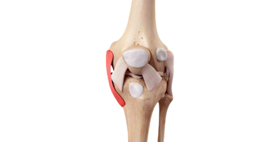 LCLR (Lateral Collateral Ligament Rüptüre)